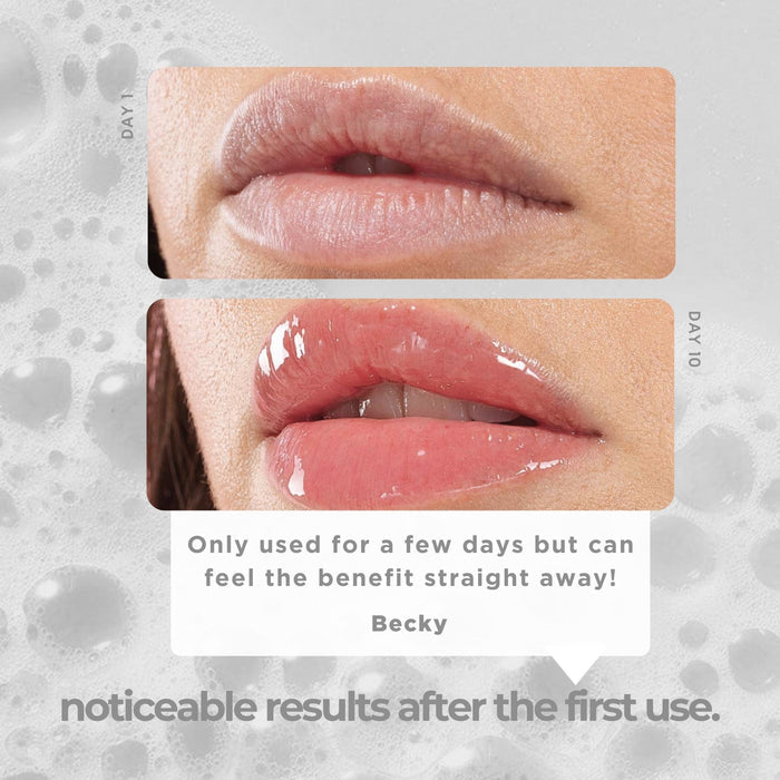 Lip Oil Trio Set - Icy Bear Dental